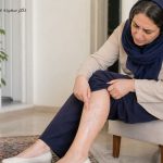 رگ‌های واریسی پا و سؤال درباره خوب شدن خودبه‌خودی واریس